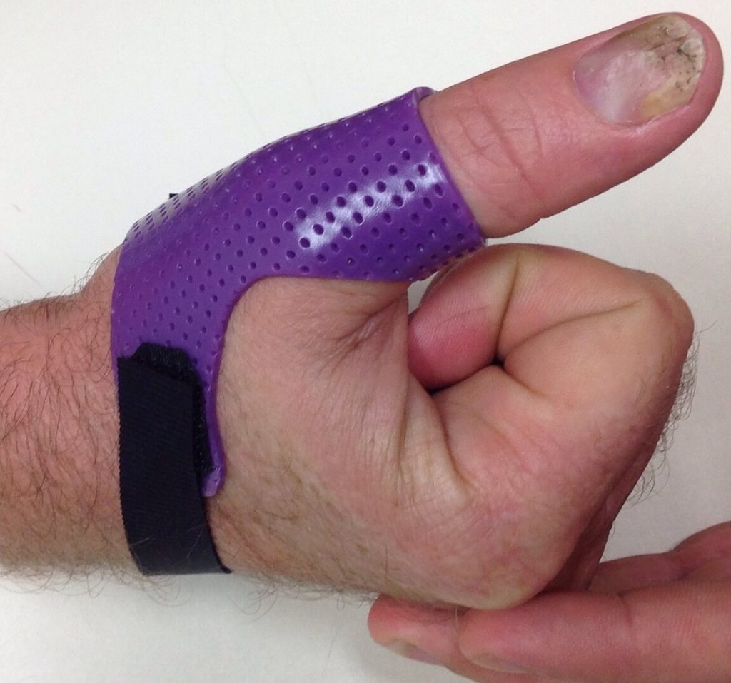 Hand Thermoplastic Splints Upper Limbs & Things